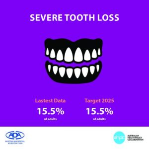 Tooth Loss